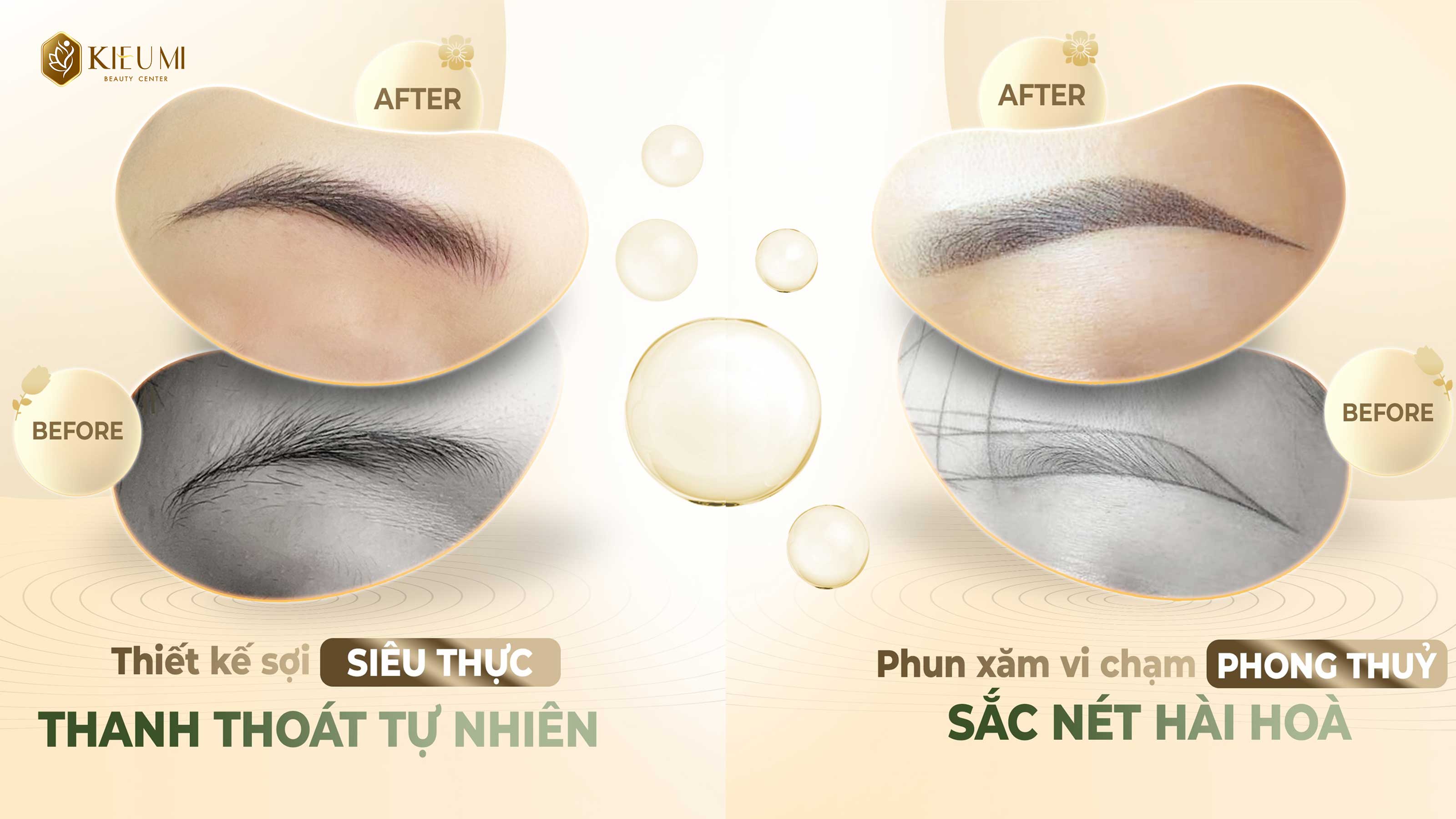  Chăm da tại nhà đúng cách sau Laser giúp da được phục hồi nhanh chóng     