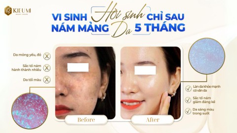  3 Phương pháp chăm da thời xưa nhưng không còn phù hợp thời nay    