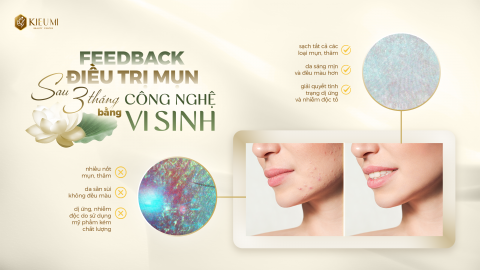  Khám Phá Nguyên Nhân & Phương Pháp Trị Mụn Từ Gốc Tại Kiều Mi Beauty  